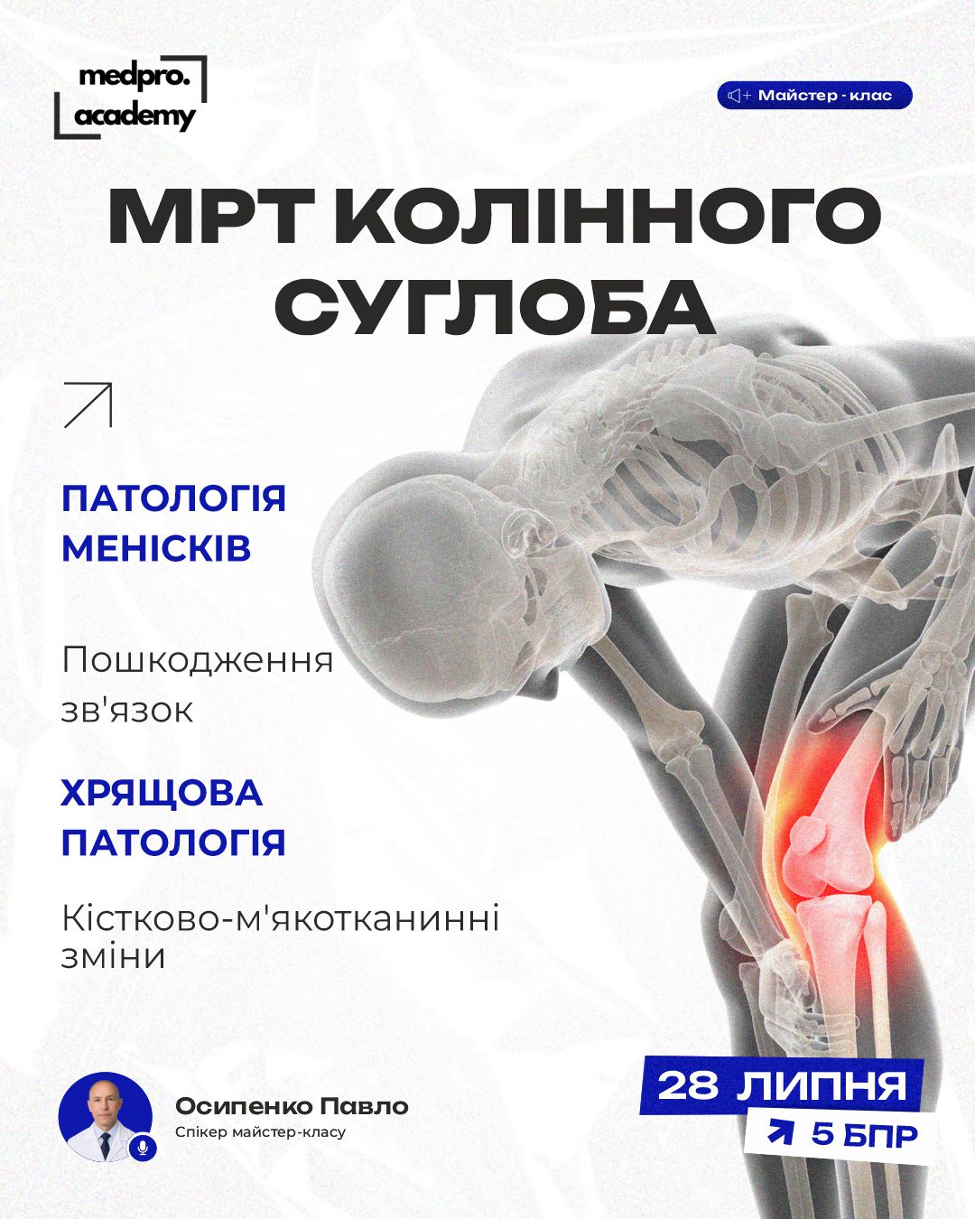 3МРТ колінного суглоба